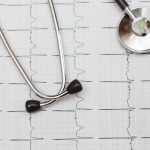 ECG test
