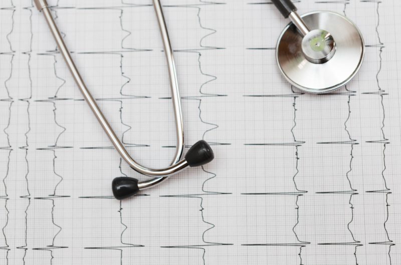 What Is an ECG and Why Might You Need One?