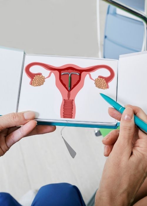 Trinity Health Care IUD 2